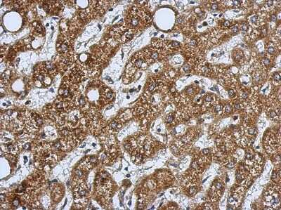 Immunohistochemistry-Paraffin: HSD17B3 Antibody [NBP2-16884]