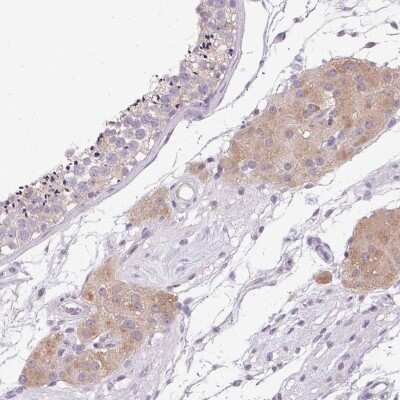 Immunohistochemistry-Paraffin: HSD17B3 Antibody [NBP2-38807]