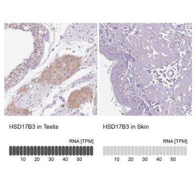 Immunohistochemistry-Paraffin: HSD17B3 Antibody [NBP2-38807]