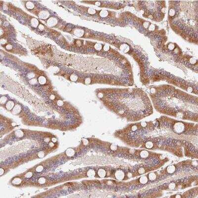Immunohistochemistry-Paraffin: HSD17B3 Antibody [NBP2-38807]