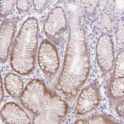 Immunohistochemistry-Paraffin: HSD17B3 Antibody [NBP2-38807]