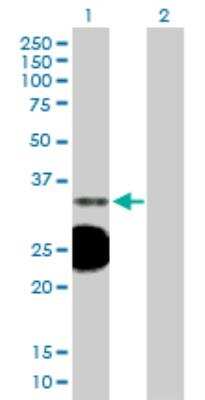 Western Blot: HSD17B3 Antibody [H00003293-B01P]