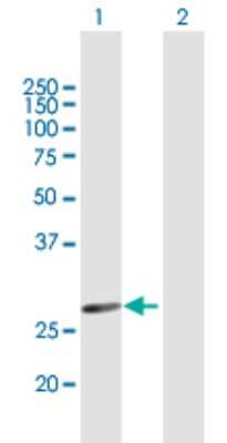 Western Blot: HSD17B3 Antibody [H00003293-B01P]