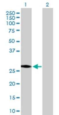 Western Blot: HSD17B3 Antibody [H00003293-D01P]