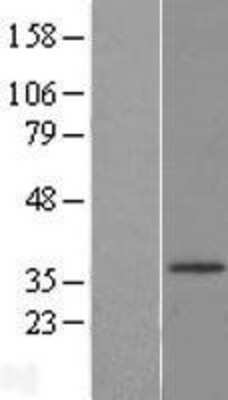 Western Blot: HSD17B3 Overexpression Lysate [NBL1-11727]