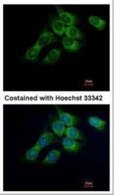 Immunocytochemistry/ Immunofluorescence: HSD17B4 Antibody [NBP1-33192]