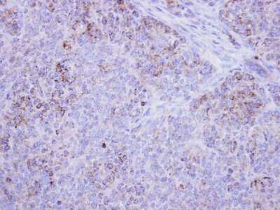 Immunohistochemistry-Paraffin: HSD17B4 Antibody [NBP1-33192]