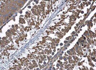 Immunohistochemistry-Paraffin: HSD17B4 Antibody [NBP1-33192]