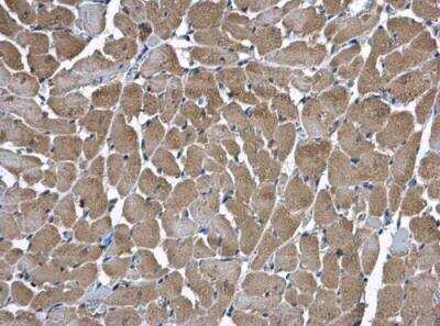 Immunohistochemistry-Paraffin: HSD17B4 Antibody [NBP1-33192]
