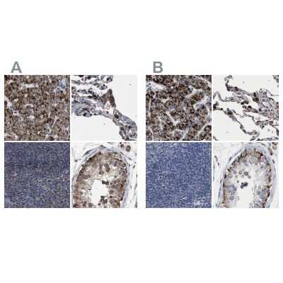 Immunohistochemistry-Paraffin: HSD17B4 Antibody [NBP1-85296]