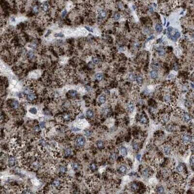 Immunohistochemistry-Paraffin: HSD17B4 Antibody [NBP1-85296]