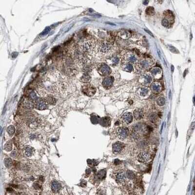 Immunohistochemistry-Paraffin: HSD17B4 Antibody [NBP1-85296]