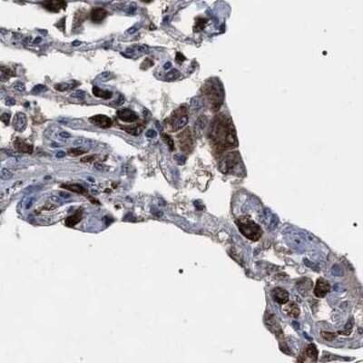 Immunohistochemistry-Paraffin: HSD17B4 Antibody [NBP1-85296]