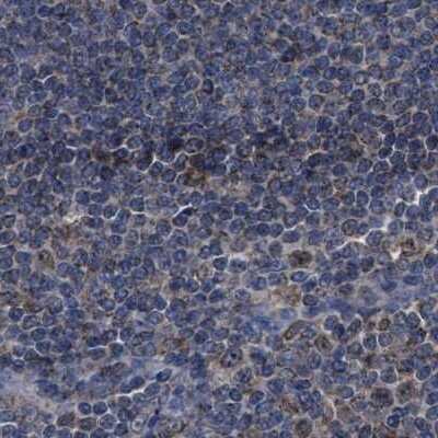 Immunohistochemistry-Paraffin: HSD17B4 Antibody [NBP1-85296]