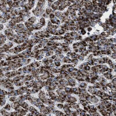 Immunohistochemistry-Paraffin: HSD17B4 Antibody [NBP1-85297]