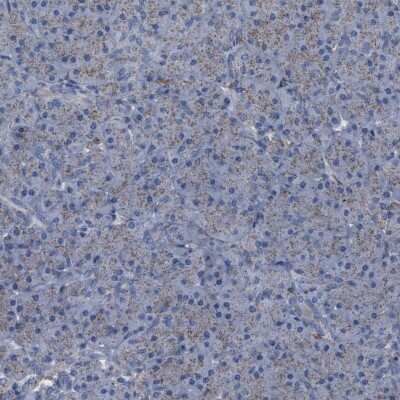 Immunohistochemistry-Paraffin: HSD17B4 Antibody [NBP1-85297]