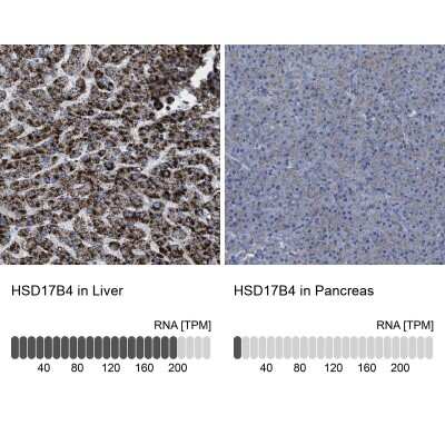 Immunohistochemistry-Paraffin: HSD17B4 Antibody [NBP1-85297]