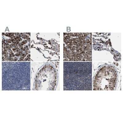 Immunohistochemistry-Paraffin: HSD17B4 Antibody [NBP1-85297]