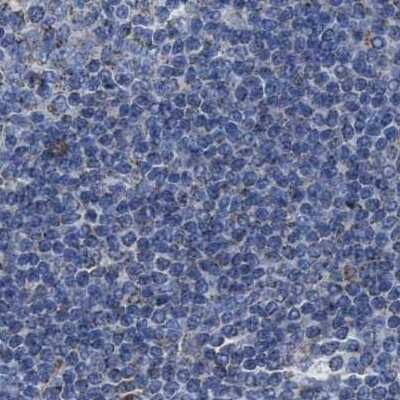 Immunohistochemistry-Paraffin: HSD17B4 Antibody [NBP1-85297]