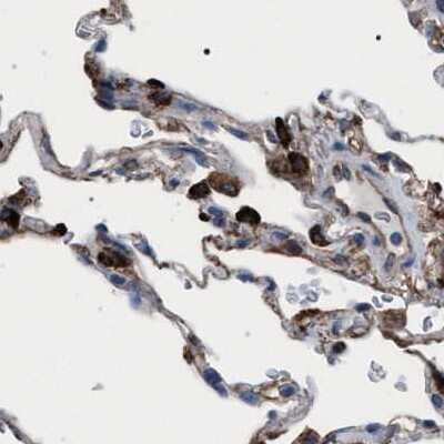 Immunohistochemistry-Paraffin: HSD17B4 Antibody [NBP1-85297]