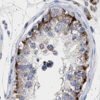 Immunohistochemistry-Paraffin: HSD17B4 Antibody [NBP1-85297]