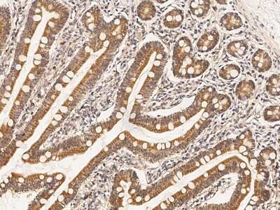 Immunohistochemistry-Paraffin: HSD17B4 Antibody [NBP2-98973]
