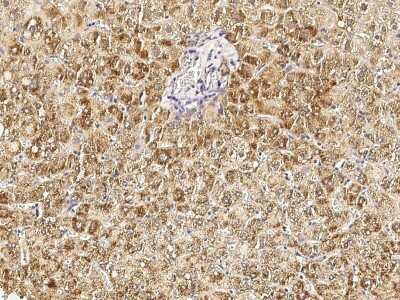 Immunohistochemistry-Paraffin: HSD17B4 Antibody [NBP2-98973]