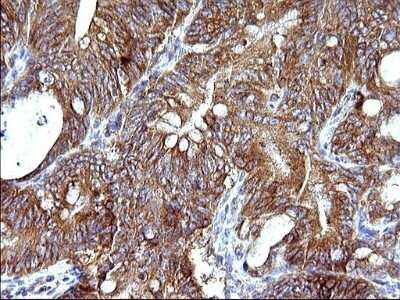 Immunohistochemistry: HSD17B4 Antibody (OTI4C4) - Azide and BSA Free [NBP2-70947]