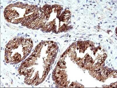 Immunohistochemistry: HSD17B4 Antibody (OTI4C4) - Azide and BSA Free [NBP2-70947]