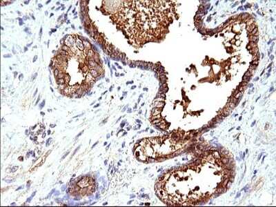Immunohistochemistry: HSD17B4 Antibody (OTI4C4) [NBP2-46005]