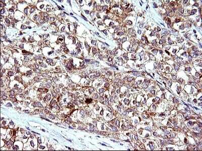 Immunohistochemistry: HSD17B4 Antibody (OTI4C4) [NBP2-46005]