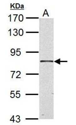 Western Blot: HSD17B4 Antibody [NBP1-33192]