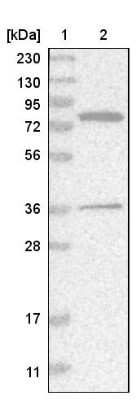 Western Blot: HSD17B4 Antibody [NBP1-85295]