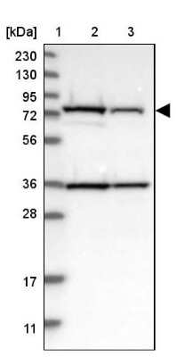 Western Blot: HSD17B4 Antibody [NBP1-85297]