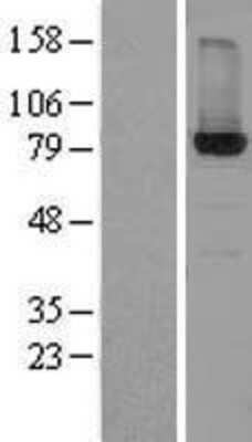 Western Blot: HSD17B4 Overexpression Lysate [NBL1-11728]