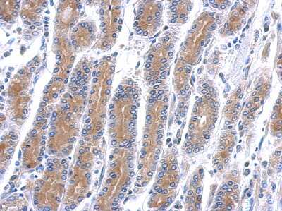 Immunohistochemistry-Paraffin: HSD17B6 Antibody [NBP1-31672]
