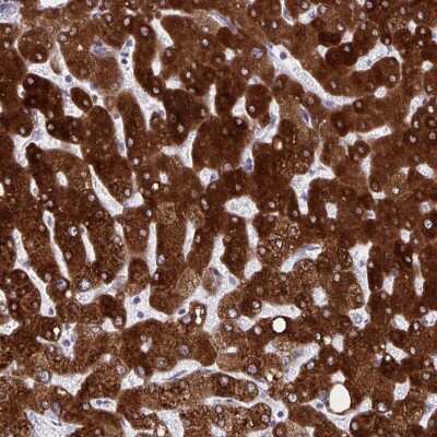 Immunohistochemistry-Paraffin: HSD17B6 Antibody [NBP2-32431]