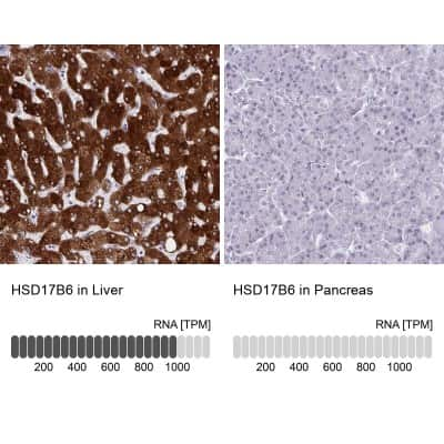 Immunohistochemistry-Paraffin: HSD17B6 Antibody [NBP2-32431]