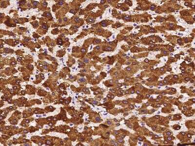 Immunohistochemistry-Paraffin: HSD17B6 Antibody [NBP2-97586]