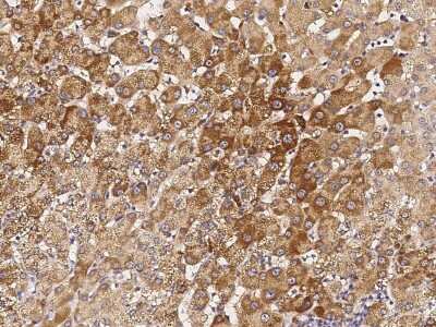 Immunohistochemistry-Paraffin: HSD17B6 Antibody [NBP2-99211]