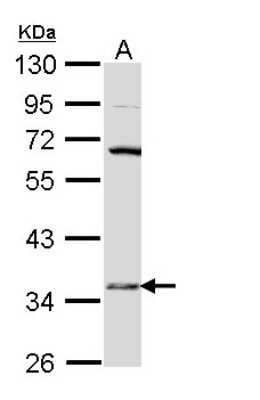 Western Blot: HSD17B6 Antibody [NBP1-31672]