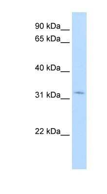 Western Blot: HSD17B6 Antibody [NBP1-56686]