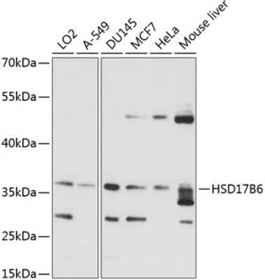 Western Blot: HSD17B6 AntibodyAzide and BSA Free [NBP3-04789]