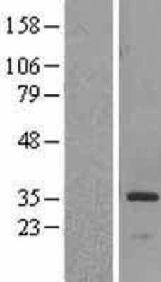 Western Blot: HSD17B6 Overexpression Lysate [NBL1-11729]