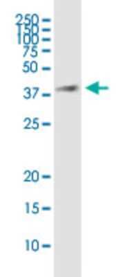 Western Blot: HSD17B7 Antibody (1G10) [H00051478-M01]