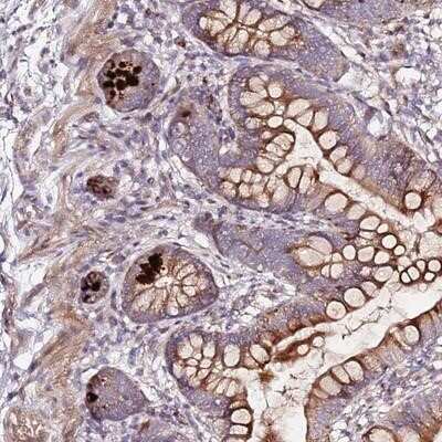Immunohistochemistry-Paraffin: HSD17B7 Antibody [NBP2-14102]