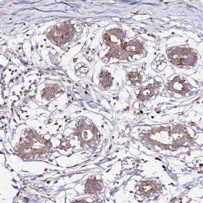 Immunohistochemistry-Paraffin: HSD17B7 Antibody [NBP2-14102]