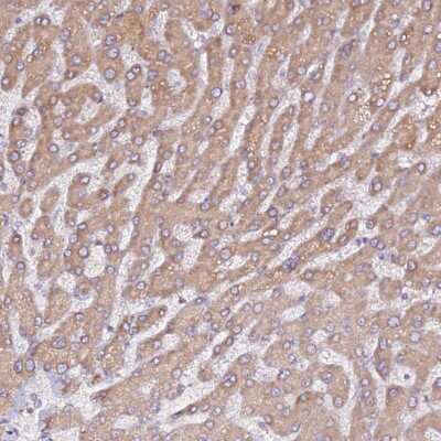 Immunohistochemistry-Paraffin: HSD17B7 Antibody [NBP2-14102]