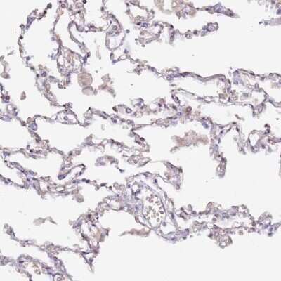 Immunohistochemistry-Paraffin: HSD17B7 Antibody [NBP2-14102]