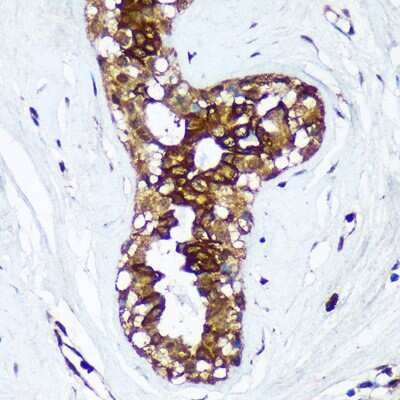Immunohistochemistry-Paraffin: HSD17B7 Antibody - Azide and BSA Free [NBP3-15527]